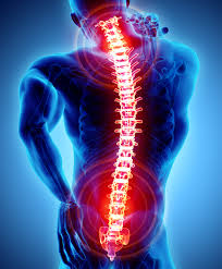 Spinal Cord Injury